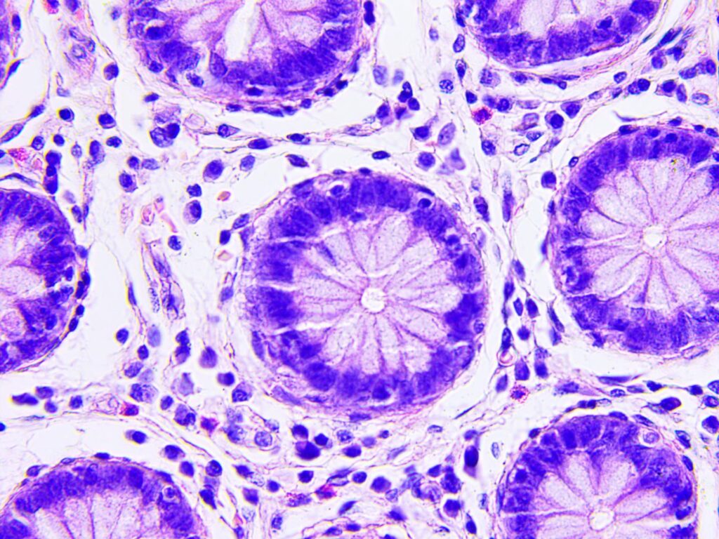 colorectal cancer cell