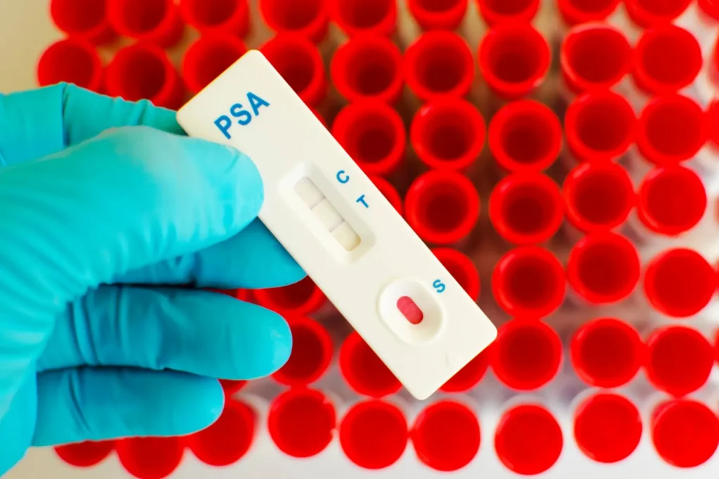 Prostate Cancer