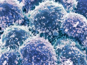 immunotherapy