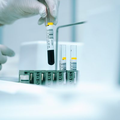 Cell Therapy