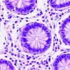 colorectal cancer cell